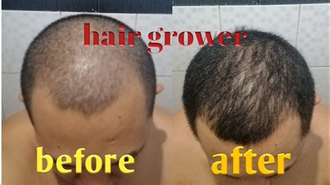 MABISANG PAMPATUBO NG BUHOK NA NATURAL .